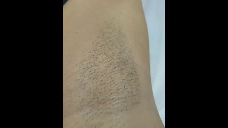 VID_63530618_081204_363.mp4